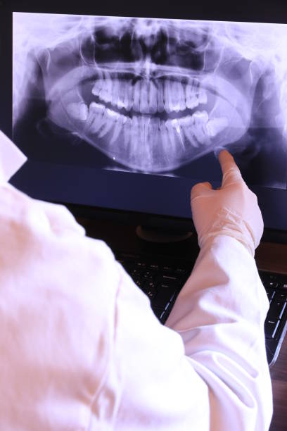 Best Emergency Dentist for Knocked-Out Tooth in Redmond, OR